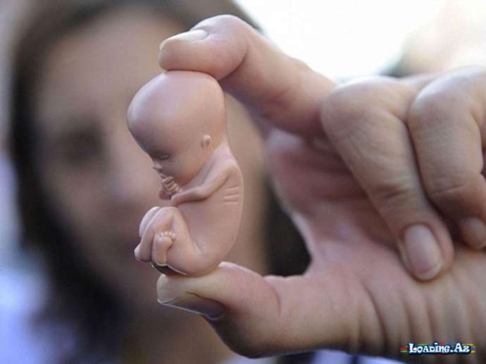Aborta görə cərimə miqdarı 5 dəfə artırıla bilər