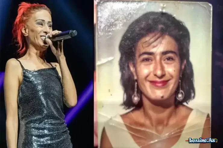 Yıldız Tilbedən illər sonra ETİRAF: “Uşaqlıqda qulağımı itirdim” - LoaDinG.Az